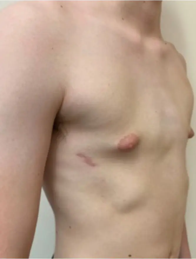 After — case 1