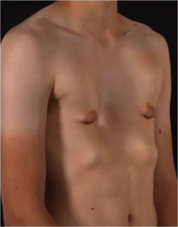 Before — case 1