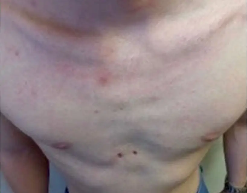 After — case 2