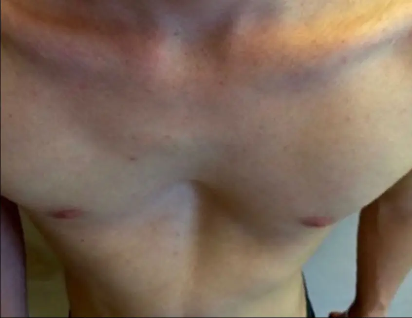 Before — case 2