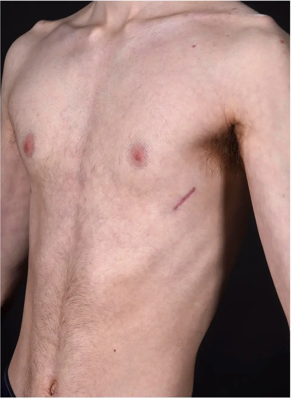 After — case 5