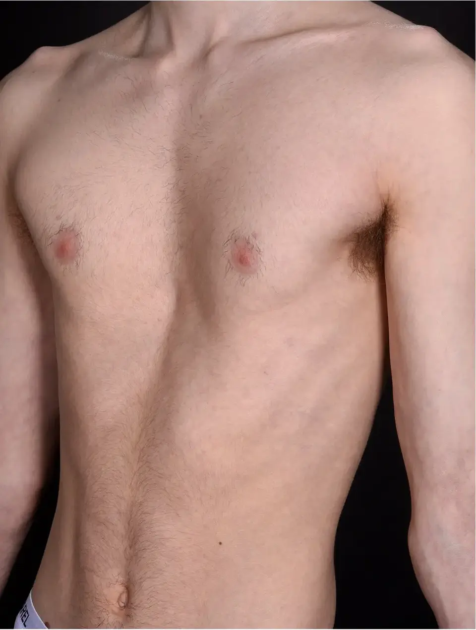 Before — case 5