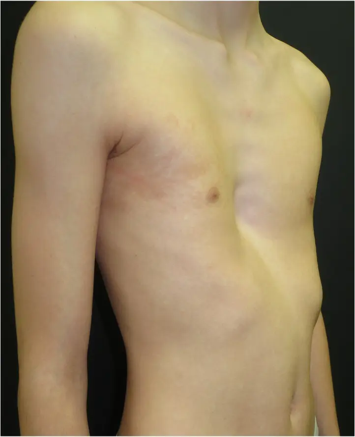 Before — case 6