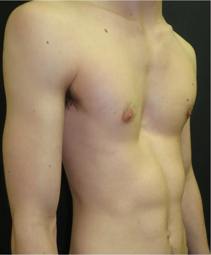 Before — case 7