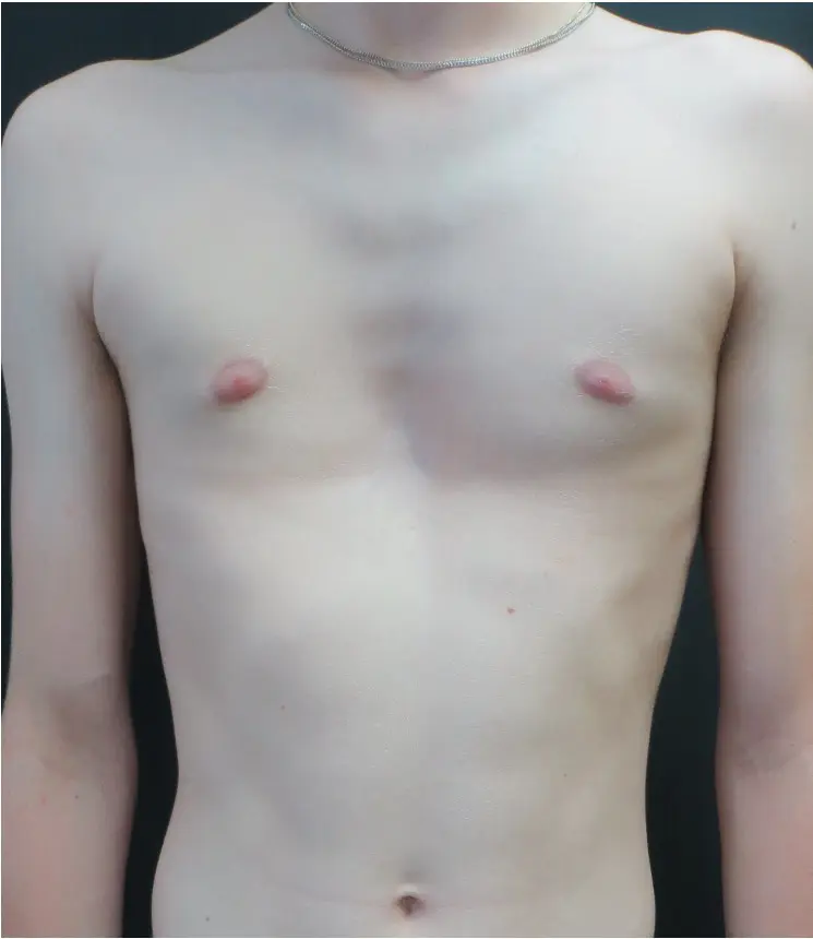 Before — case 8