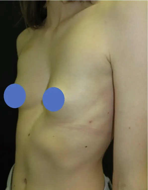 Before — case 9