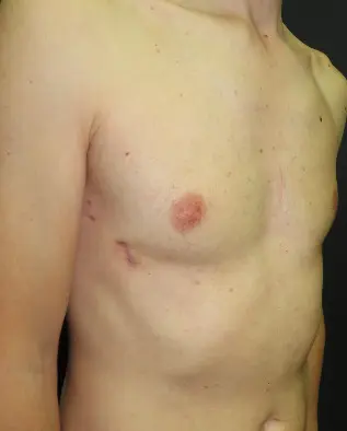 After — case 10