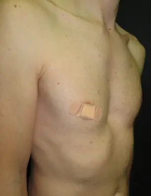 Before — case 10