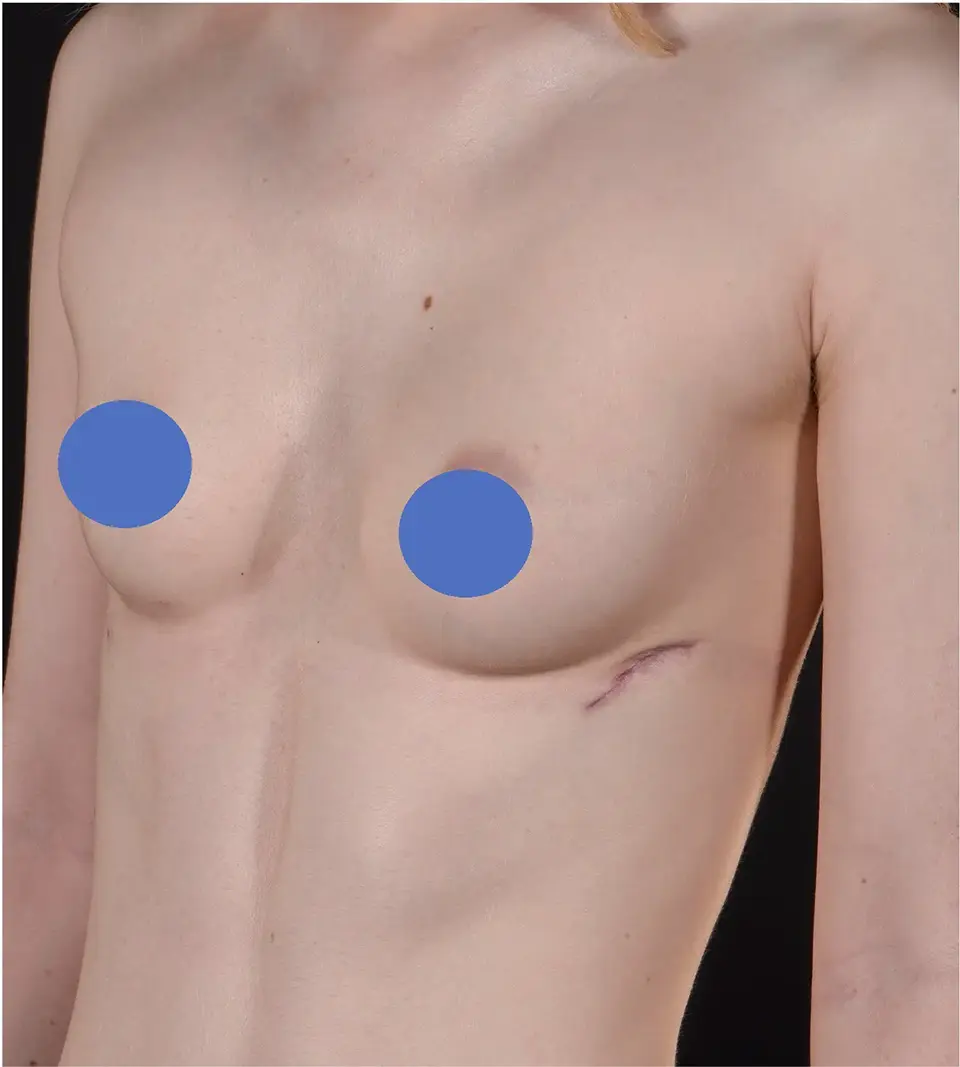 After — case 12