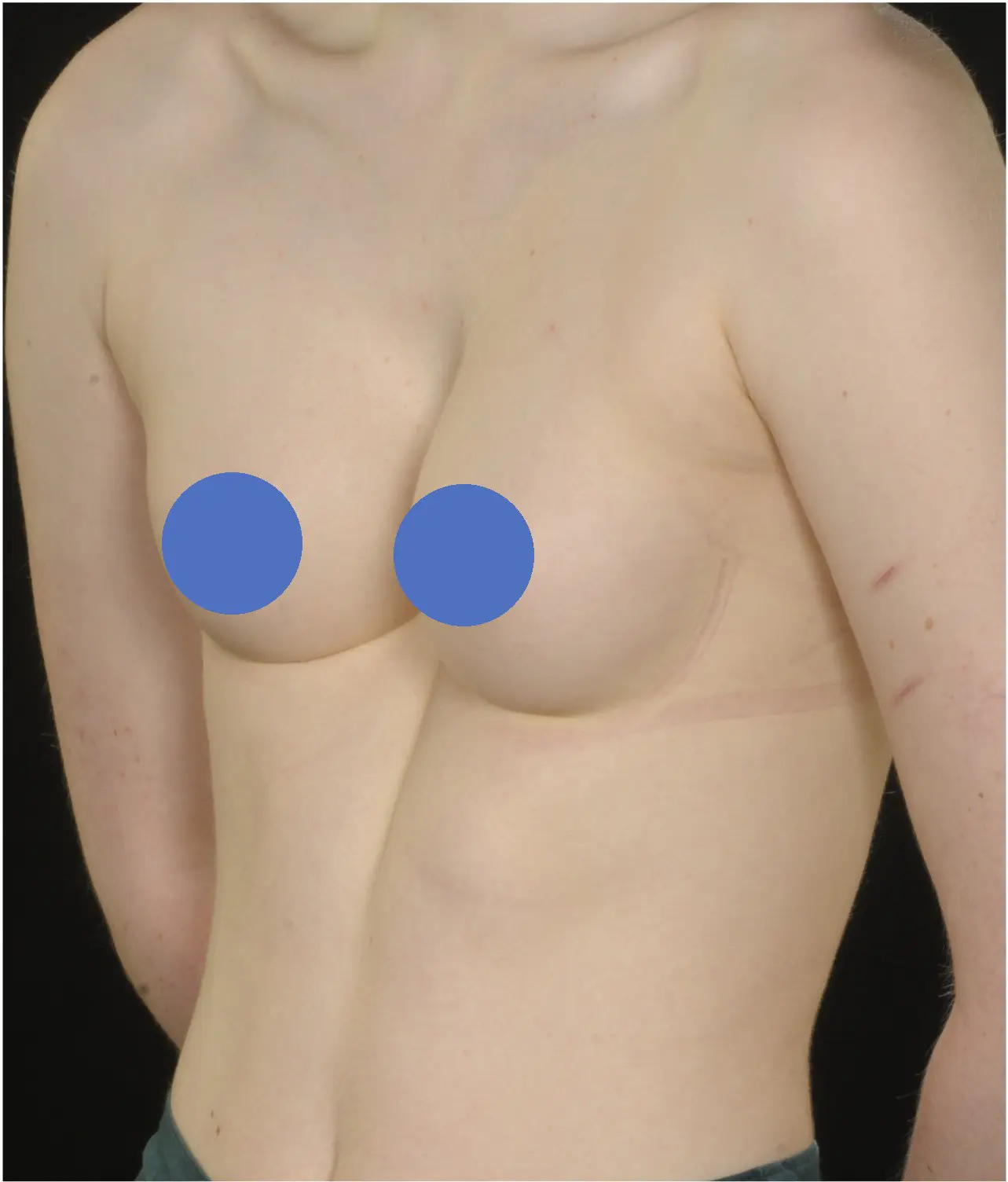 Before — case 12
