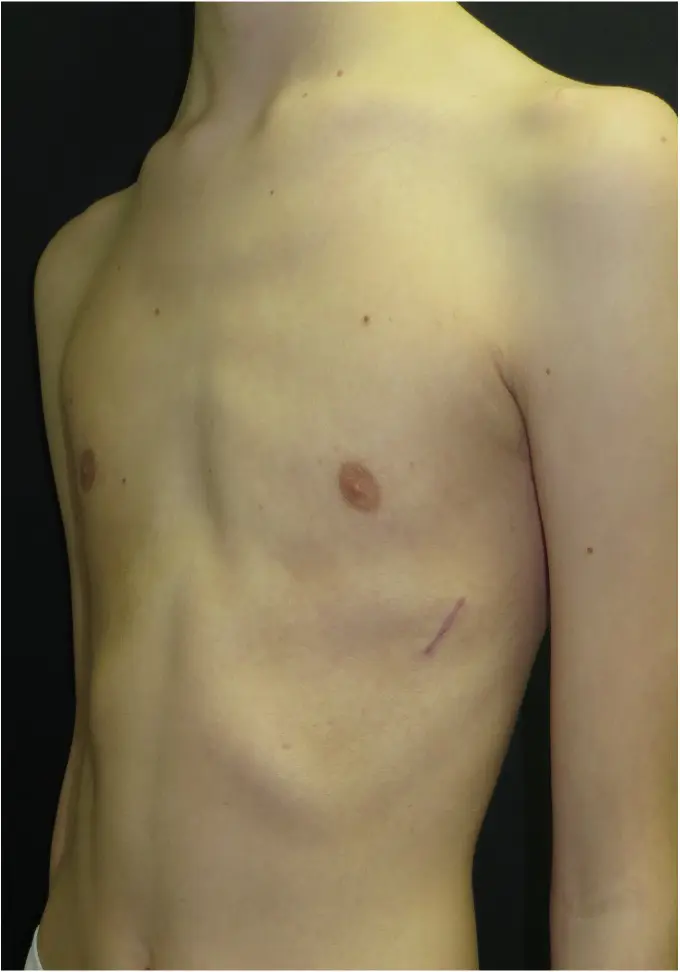 After — case 13