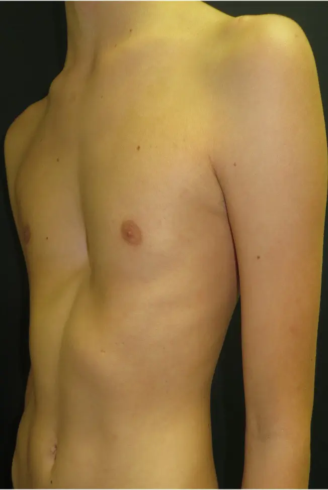 Before — case 13
