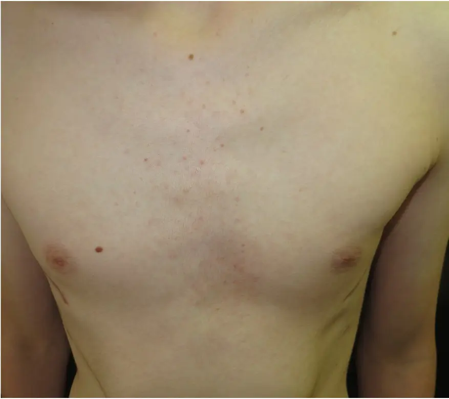 After — case 14