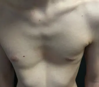 Before — case 14