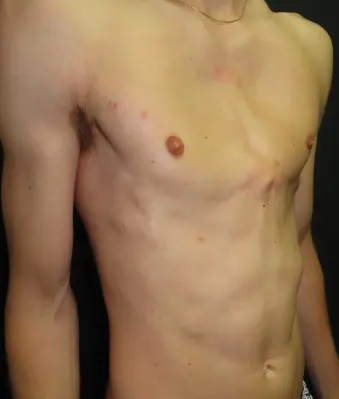 After — case 15