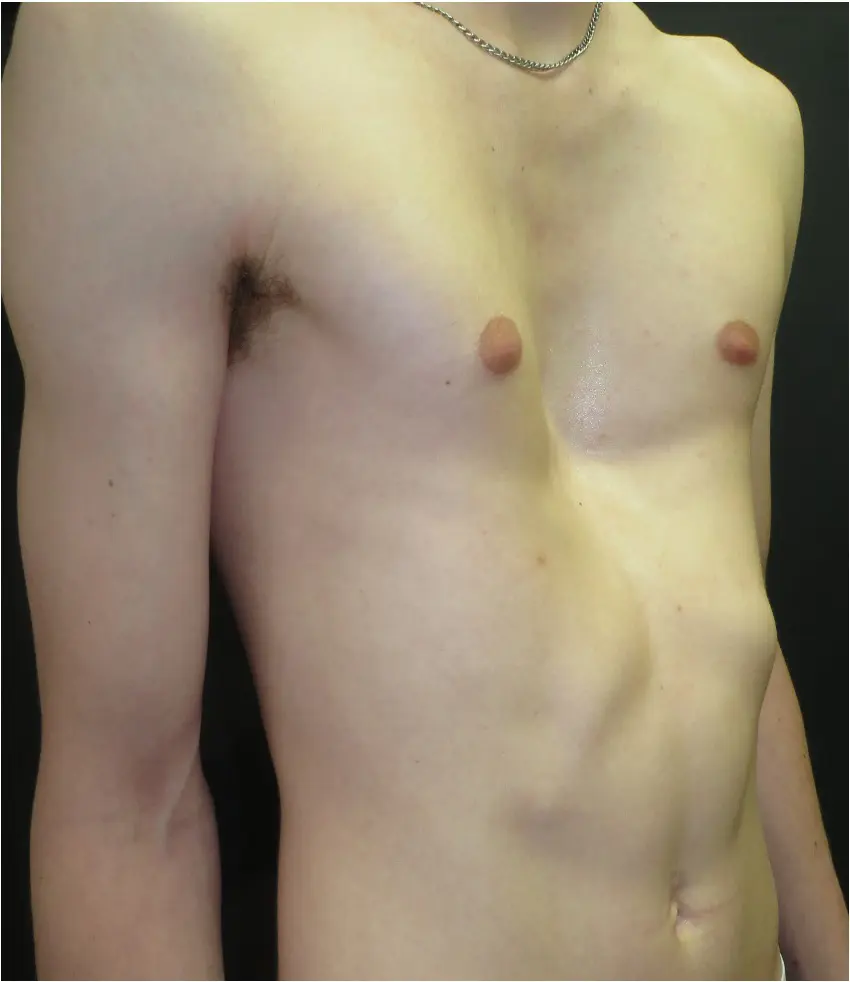 Before — case 15