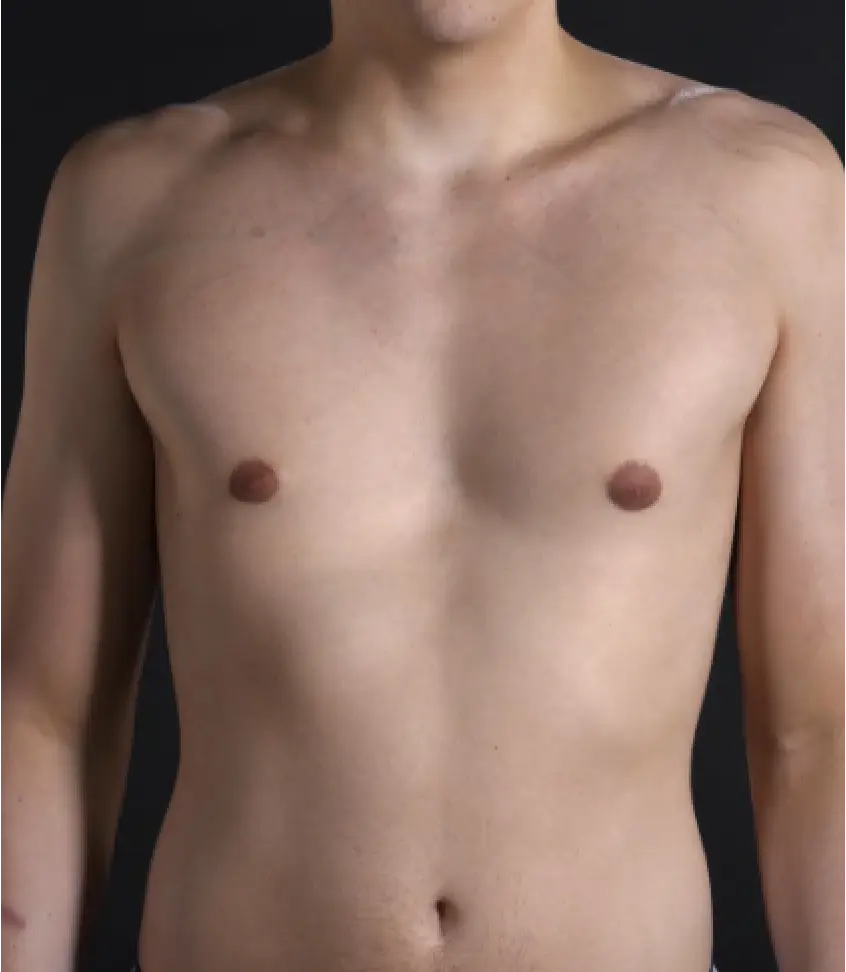 Before — case 16