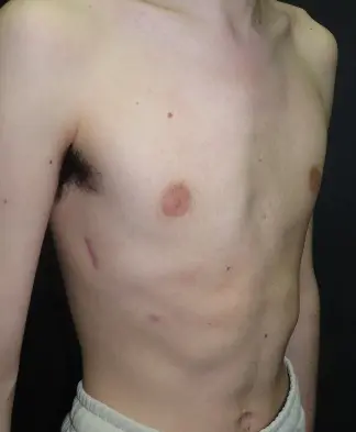 After — case 19