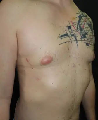 After — case 20