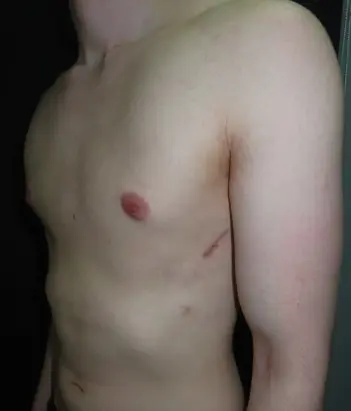 After — case 21