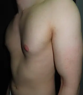 Before — case 21