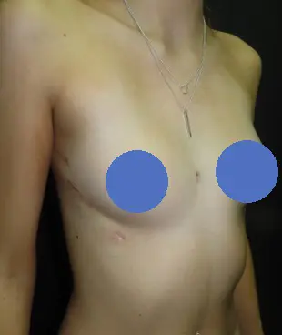 After — case 22