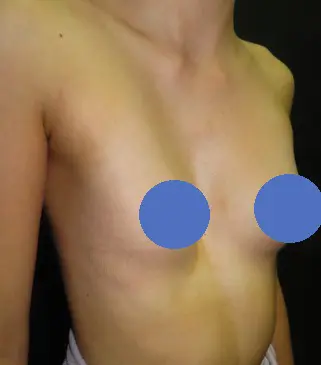 Before — case 22