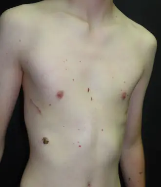 After — case 24