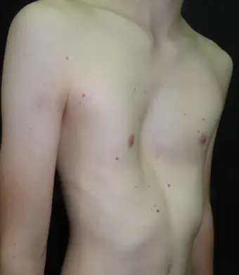 Before — case 24