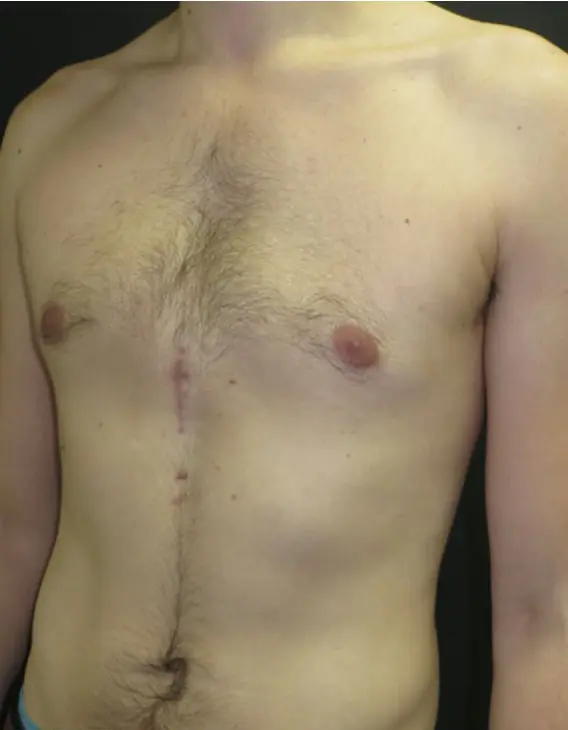 After — case 1