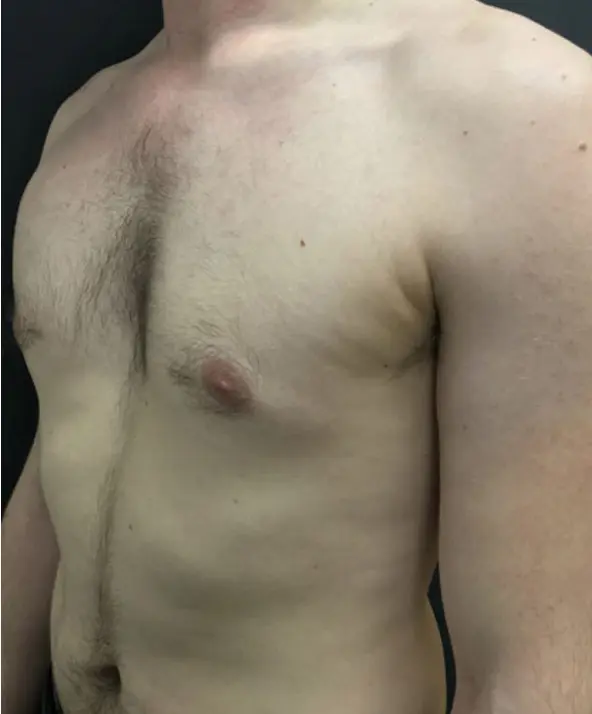 Before — case 1
