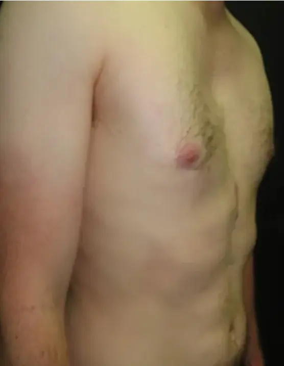 After — case 2