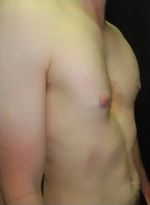 Before — case 2