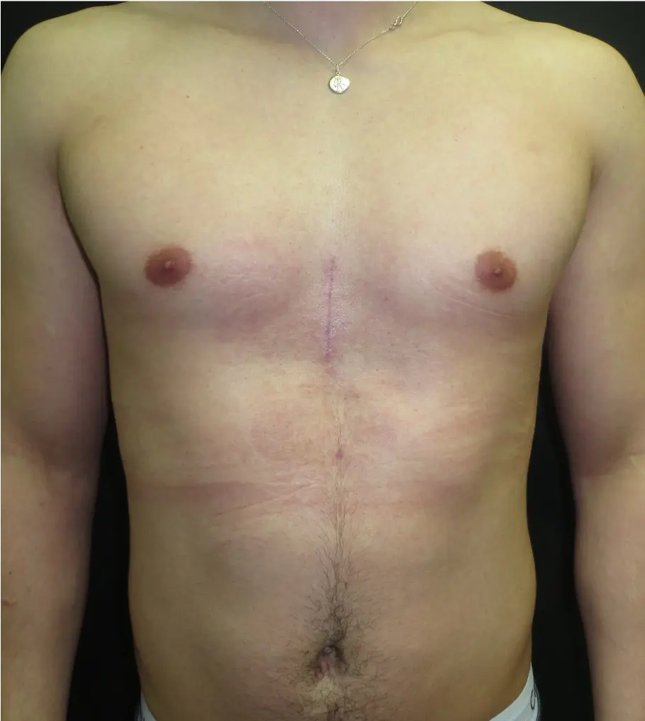 After — case 4