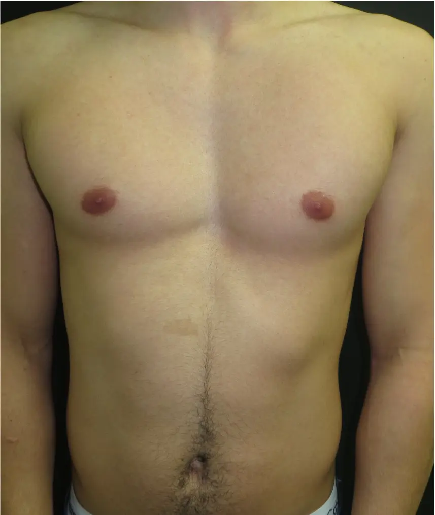 Before — case 4