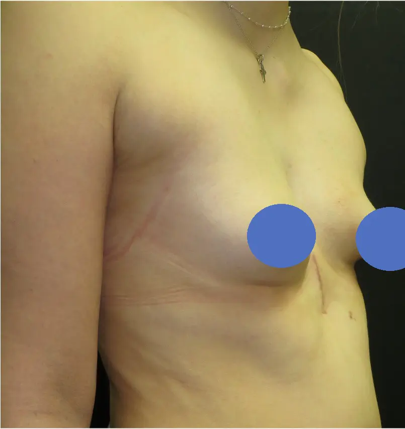 After — case 5