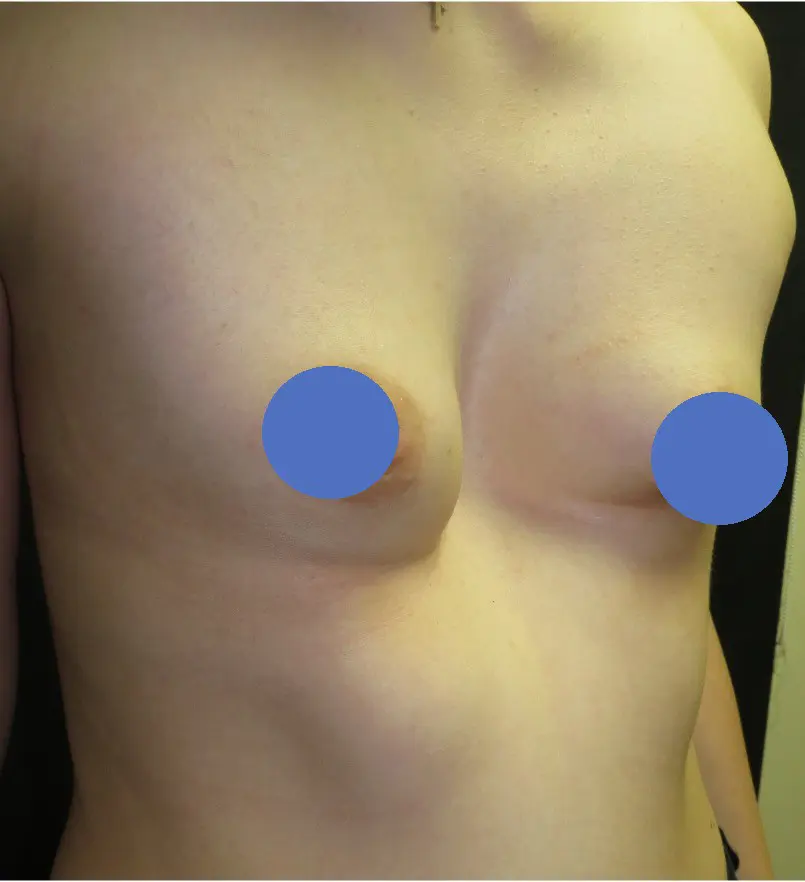 Before — case 5
