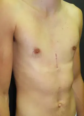 After — case 6