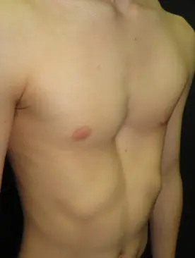 Before — case 6