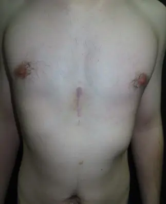 After — case 8