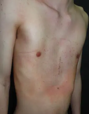 After — case 9