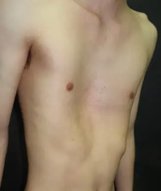 Before — case 9