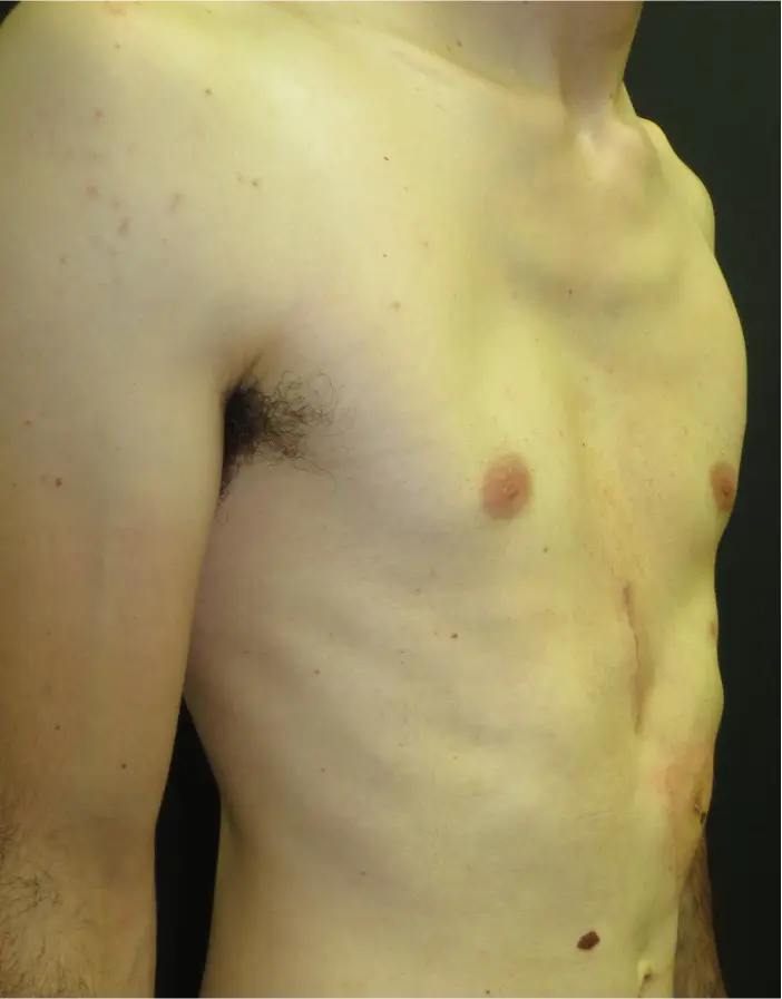 After — case 10