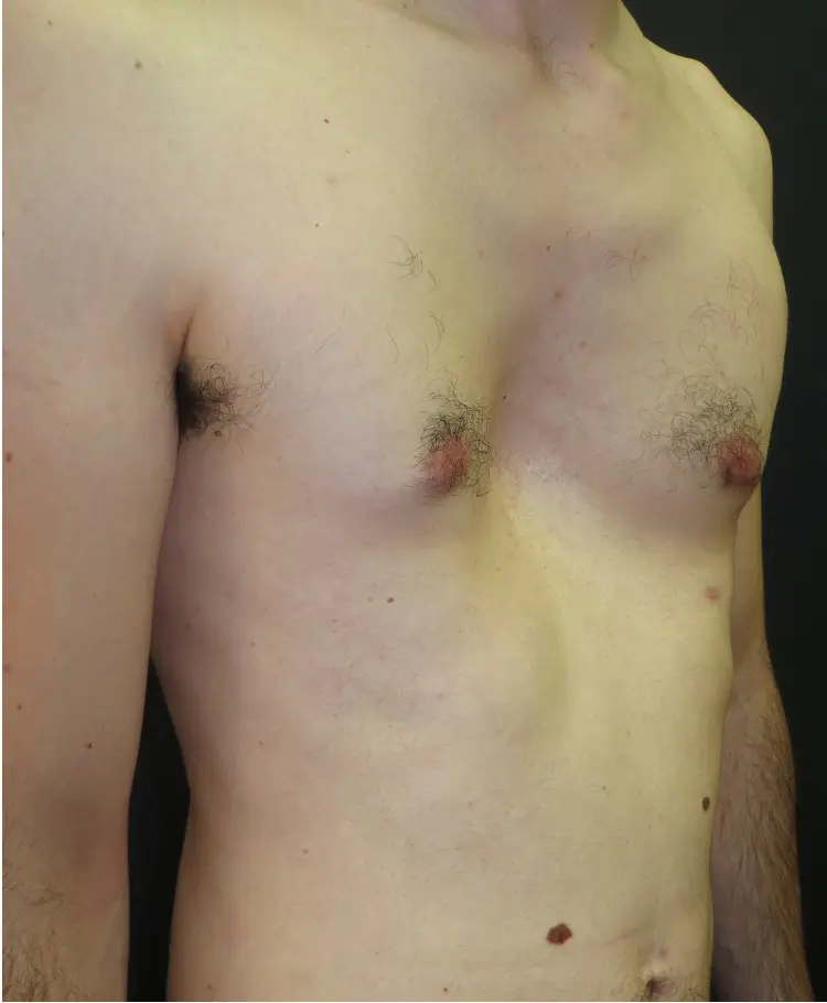 Before — case 10