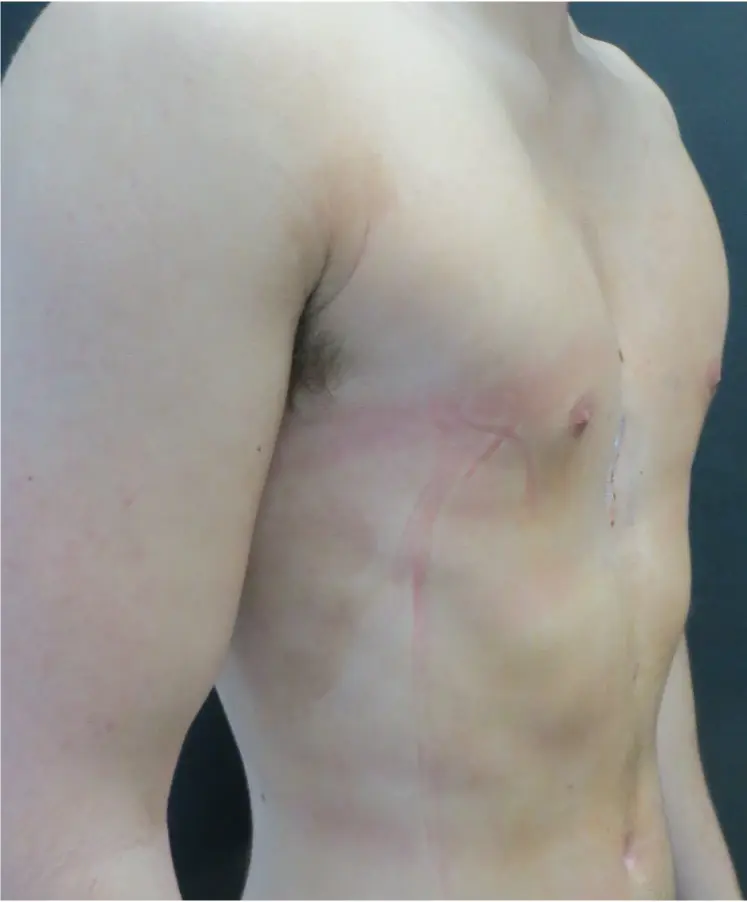 After — case 11