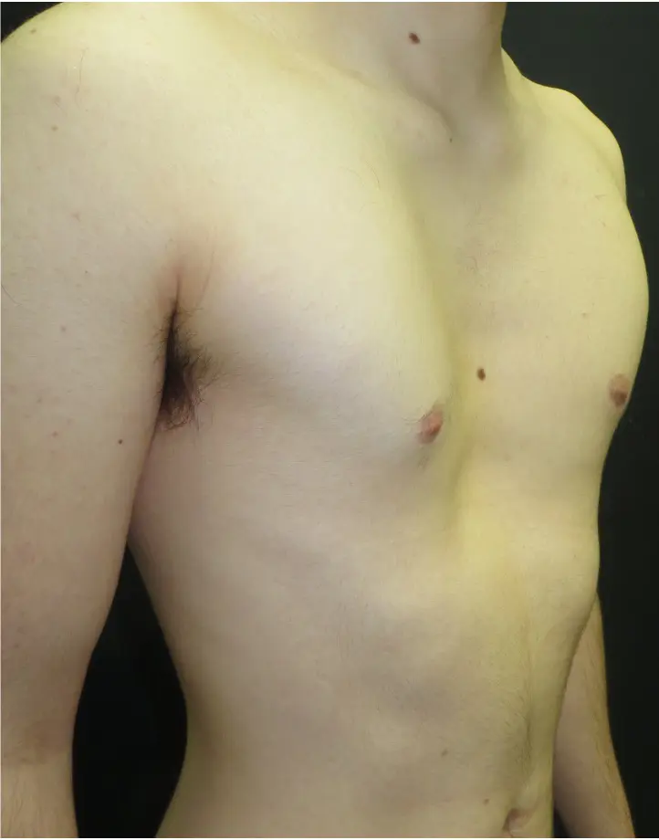 Before — case 11