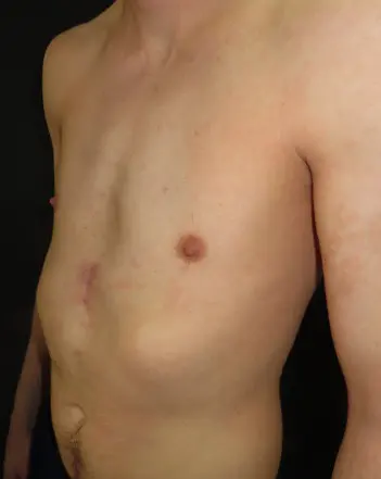 After — case 12