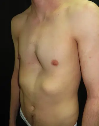 Before — case 12