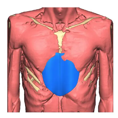 Muscle layer — custom implant in place