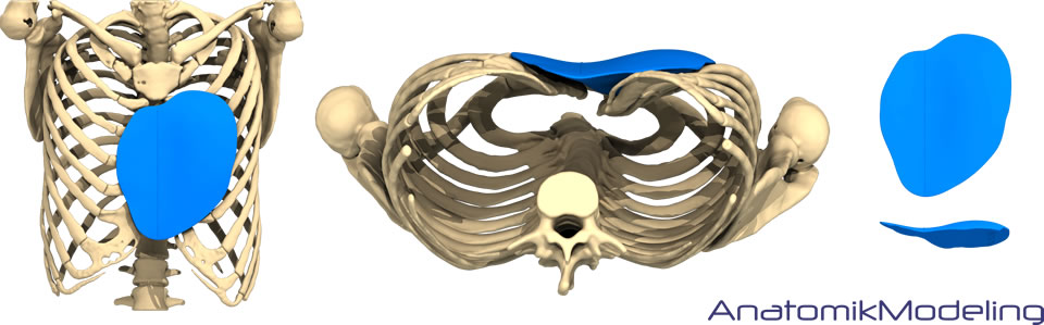 Prosthetic pectus implants 3D CT technology